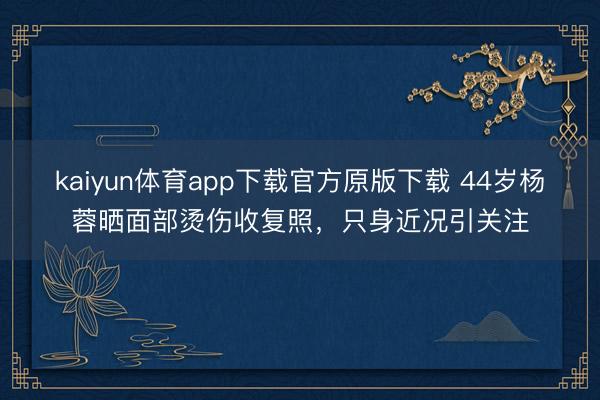 kaiyun体育app下载官方原版下载 44岁杨蓉晒面部烫伤收复照,只身近况引关注