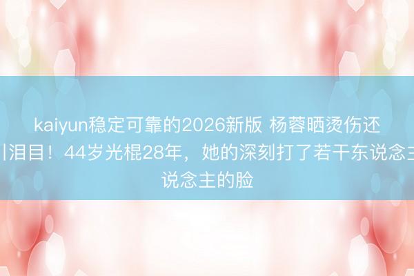 kaiyun稳定可靠的2026新版 杨蓉晒烫伤还原照引泪目!44岁光棍28年,她的深刻打了若干东说念主的脸